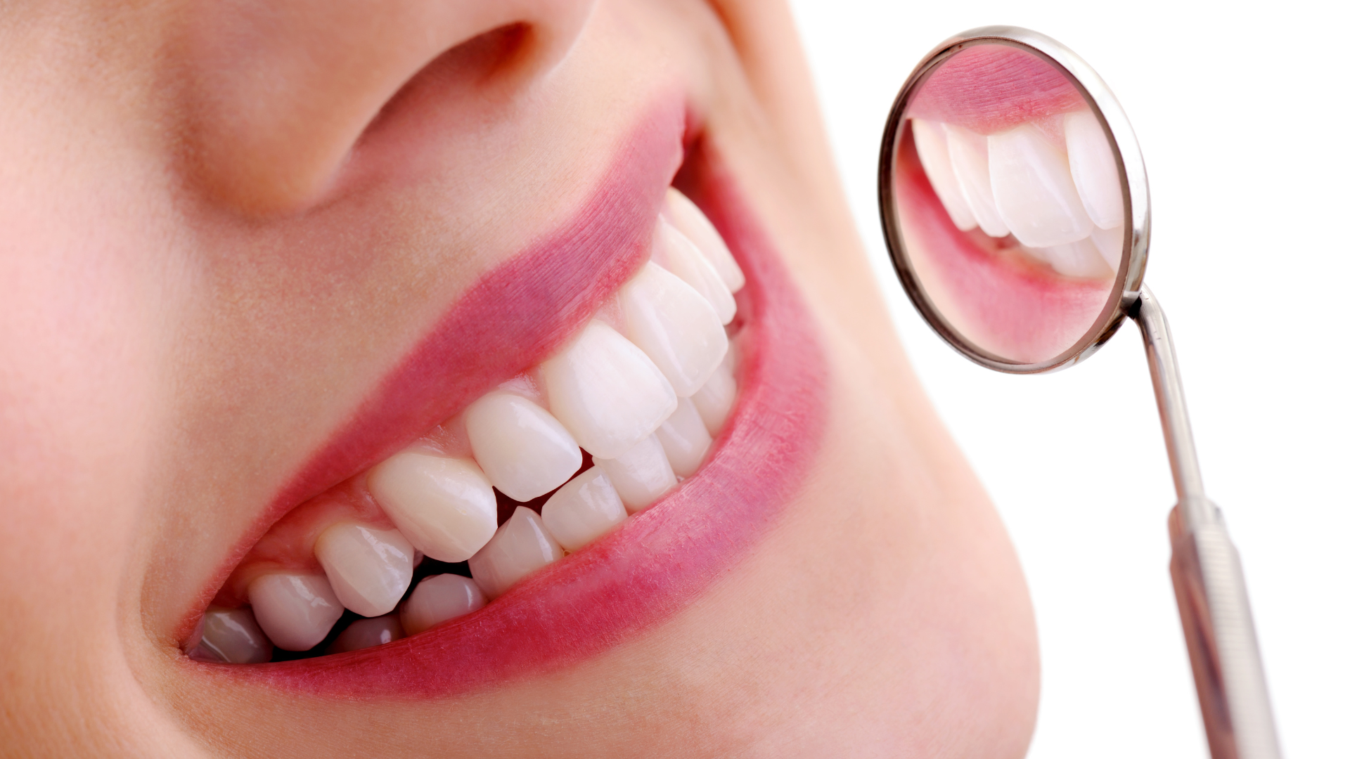 una sonrisa con una pieza de odontología