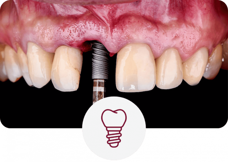 Tratamientos Dentales Estéticos Nova Dental