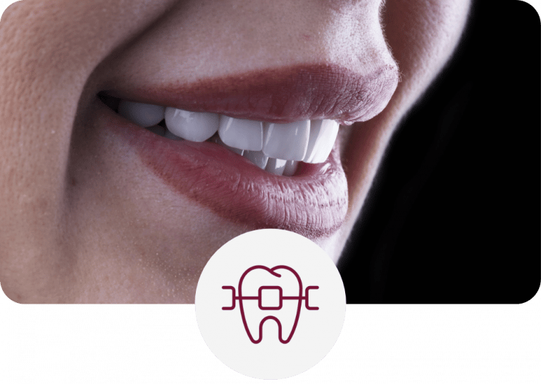 Tratamientos Dentales Estéticos Nova Dental